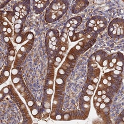 FFAR3/GPR41 Antibody, Novus Biologicals:Antibodies:Primary Antibodies